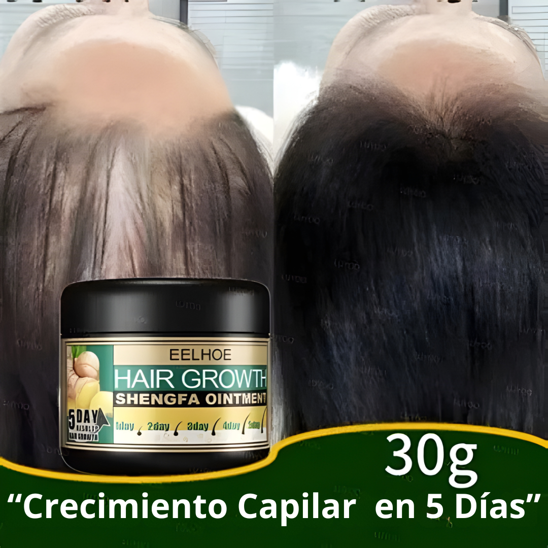 Crema de Jengibre – Recupera tu Cabello en 30 Días